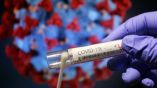 189 новых случаев заражения коронавирусом в Болгарии