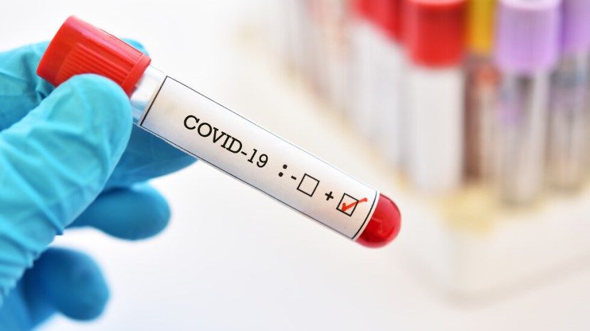267 са новите случаи на COVID-19 у нас