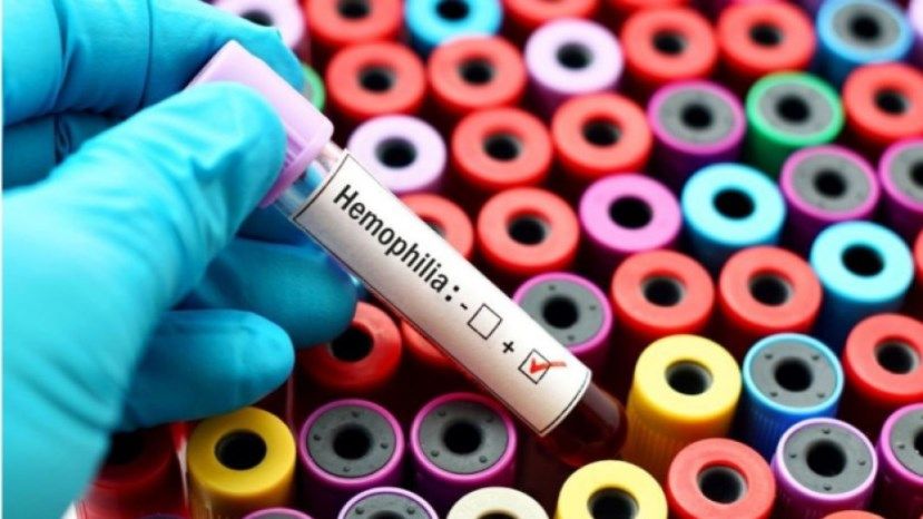 2126 новых случаев заражения коронавирусом в Болгарии