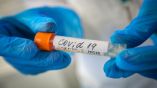 359 новых случаев заражения коронавирусом в Болгарии