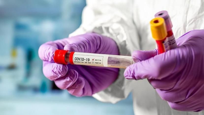 2 379 новых случаев заражения коронавирусом в Болгарии