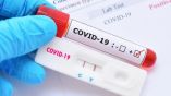 595 новых случаев заражения коронавирусом в Болгарии