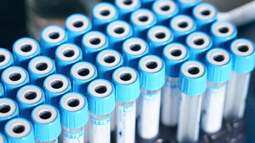 276 новых случаев заражения коронавирусом в Болгарии