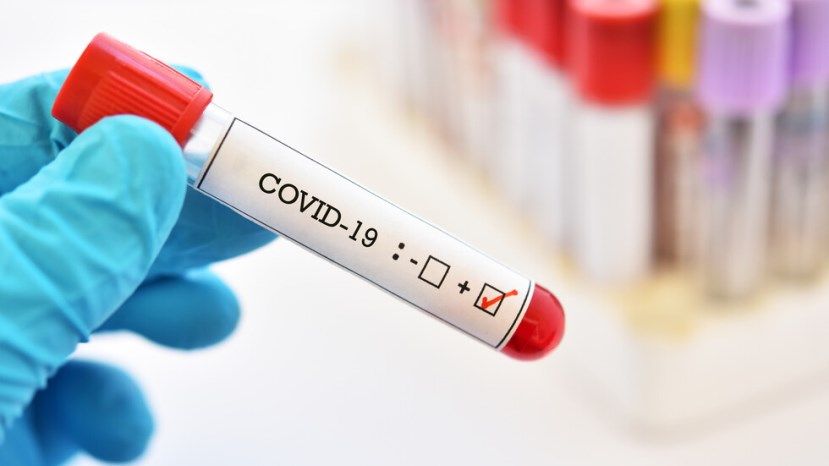 1123 новых случая заражения коронавирусом в Болгарии