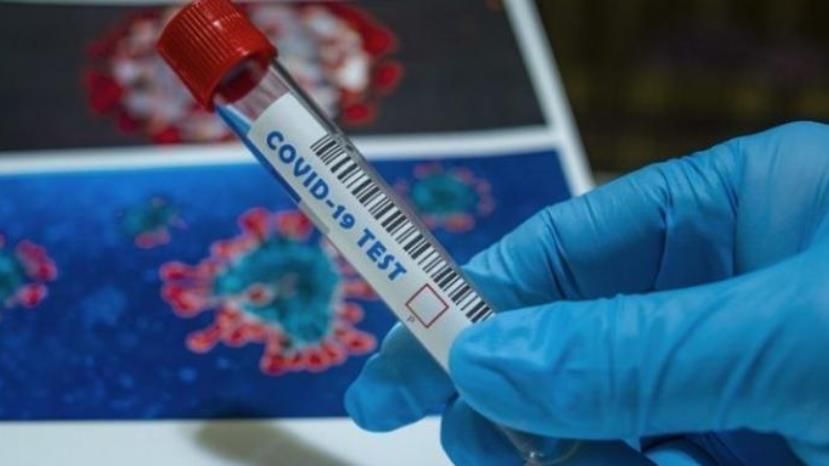 741 новый случай заражения коронавирусом в Болгарии