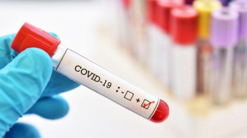 157 новых случаев заражения коронавирусом в Болгарии