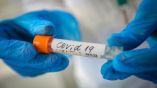 472 нови положителни за коронавируса - 12,83% от изследваните