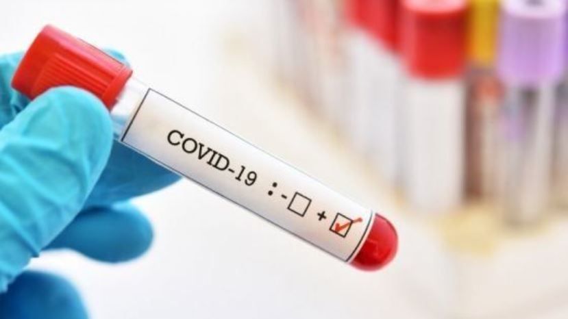 55 са новите болни от COVID
