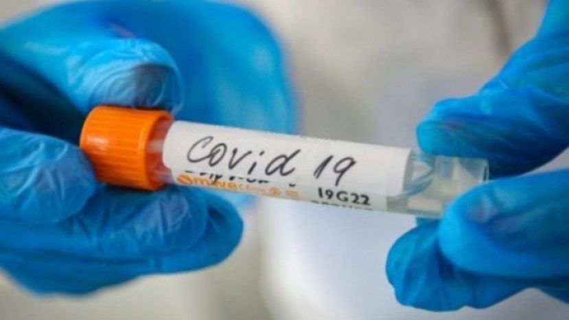 2191 са новите случаи на COVID у нас