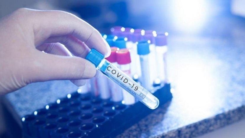 126 новых случаев заражения коронавирусом в Болгарии