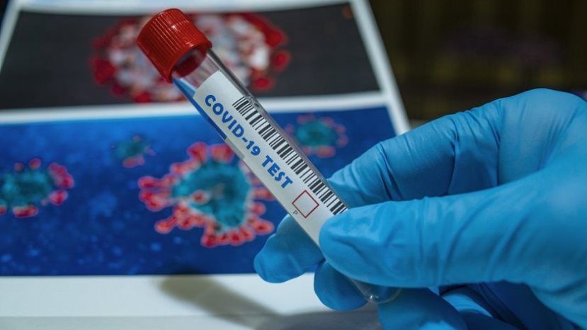 109 новых случаев заражения коронавирусом в Болгарии