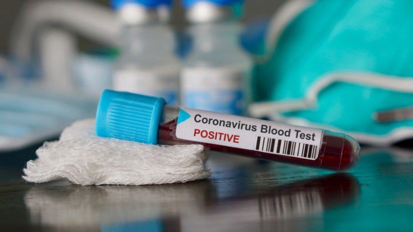 119 новых случаев заражения коронавирусом в Болгарии