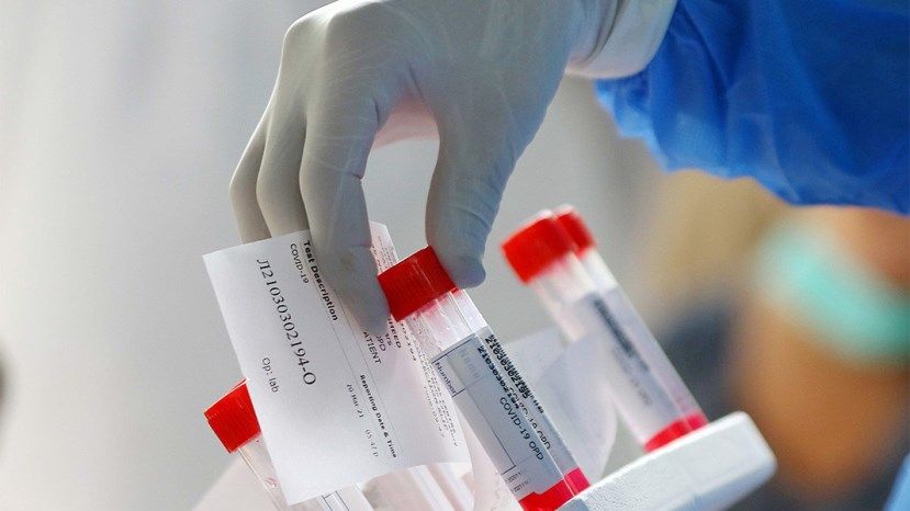 2 806 новых случаев заражения коронавирусом в Болгарии