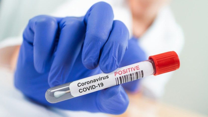 86 са новозаразените с коронавирус, двама са починали за последните 24 часа