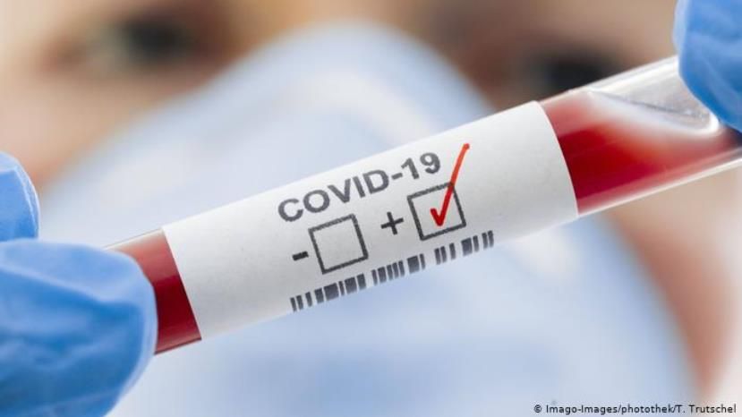 1635 новых случаев заражения коронавирусом в Болгарии