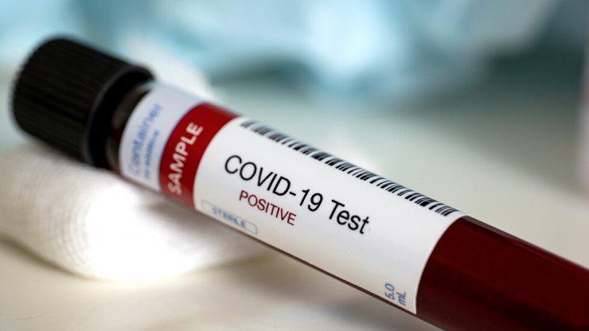 10 са новите случаи на COVID-19 у нас