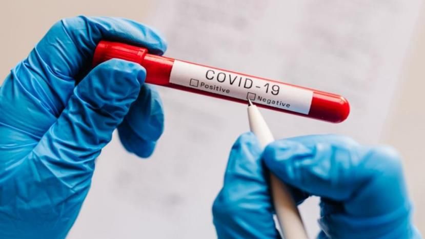 57 новых случаев заражения коронавирусом в Болгарии