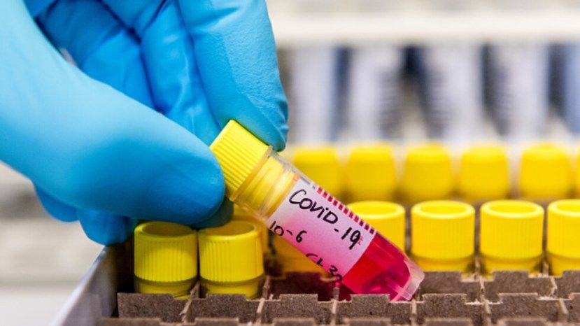 17 са новите случаи на коронавирус у нас, има три нови жертви