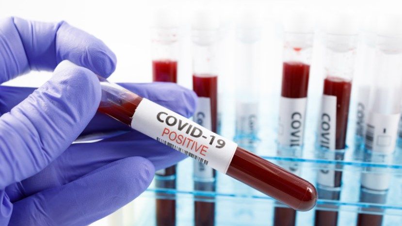 174 са новите заразени с COVID-19, 8 починаха за ден