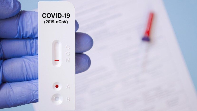 3983 са новозаразените с COVID-19 – 40,7% от тестваните, 129 са починали