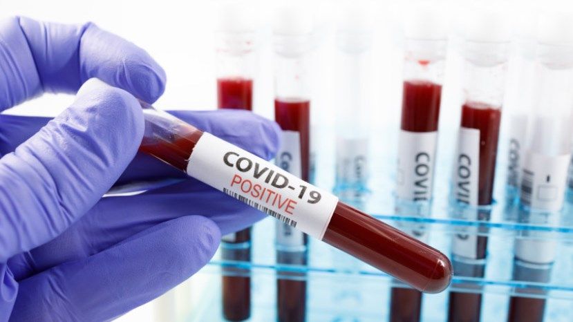 265 новых случаев заражения коронавирусом в Болгарии