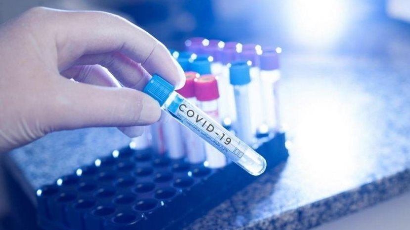 1 716 новых случаев заражения коронавирусом в Болгарии