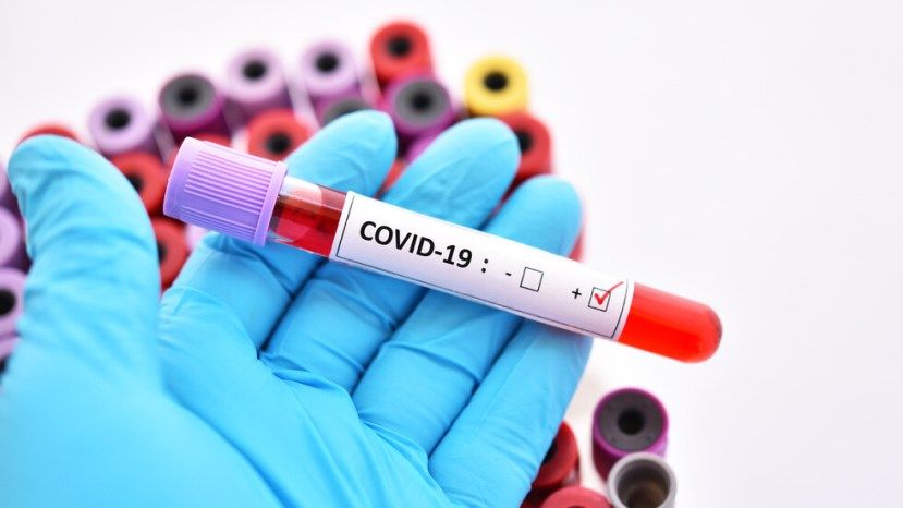 270 новых случаев заражения коронавирусом в Болгарии