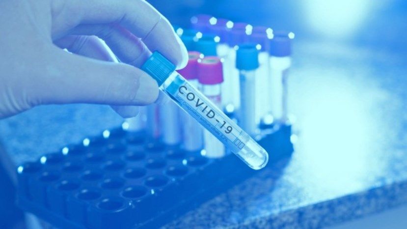 3568 новых случаев заражения коронавирусом в Болгарии