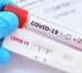 595 новых случаев заражения коронавирусом в Болгарии